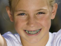 Braces